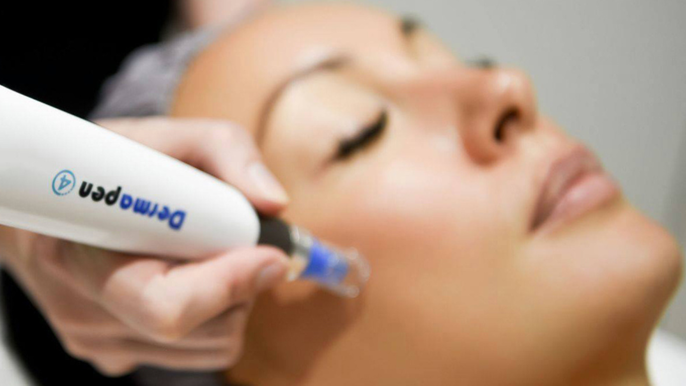 prepping skin for dermapen skin needling